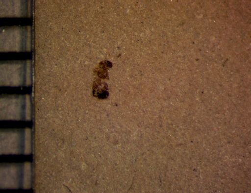 undet. Insecta