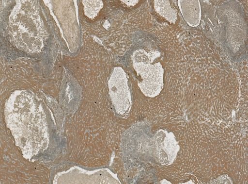 Taenia crassicollis