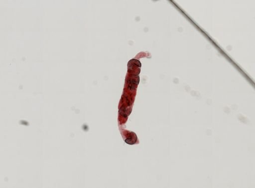 Trematoda