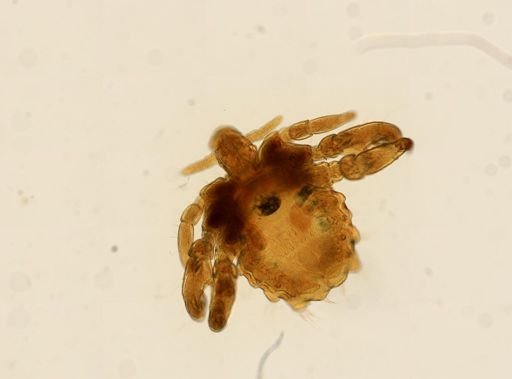 Pthirus pubis