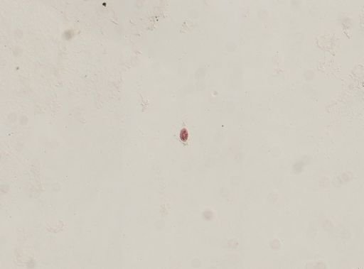 Oxytricha