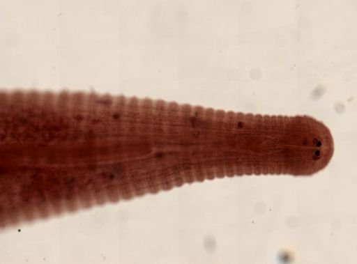 Hirudinea