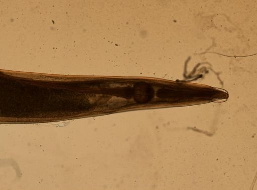 Enterobius vermicularis