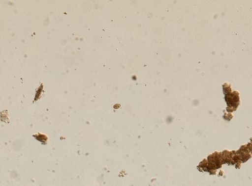 Diphyllobothrium canis