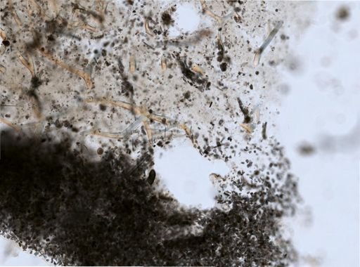 Keratosa