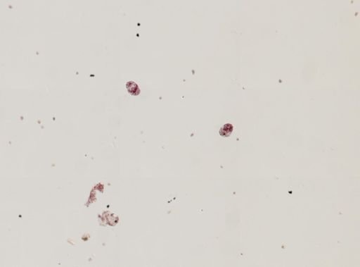 Fasciola hepatica
