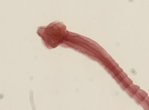 Dipylidium caninum