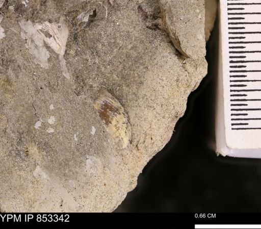 Protocardia?