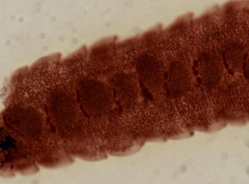 Eucestoda