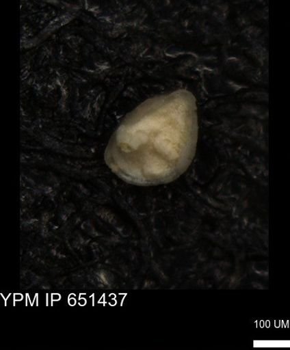 undet. Foraminiferida