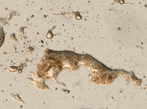 Diphyllobothrium canis