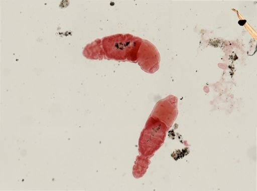 Dinophilus gyrociliatus