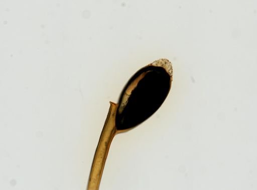Pthirus pubis