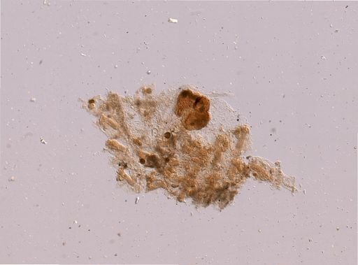 Microporella