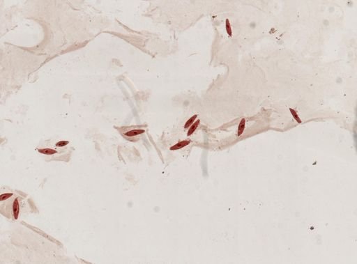 Paramecium