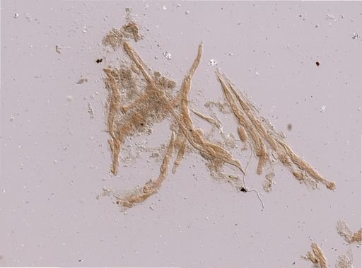 Bryozoa