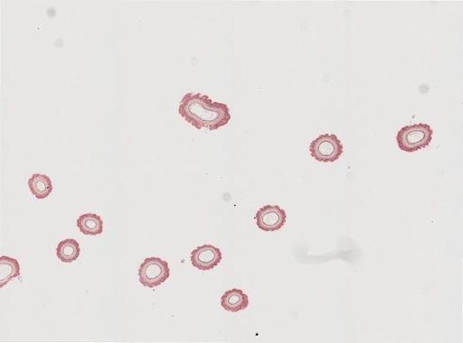 Edwardsia sp.