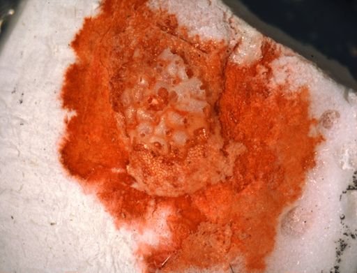 Phonicosia
