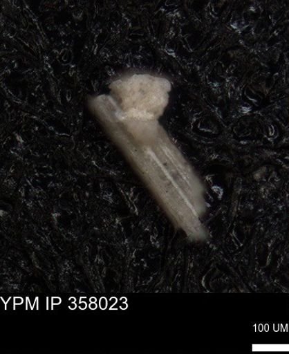 undet. Echinoidea