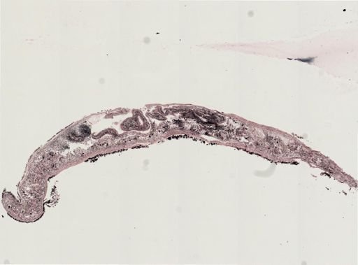 Euplana gracilis