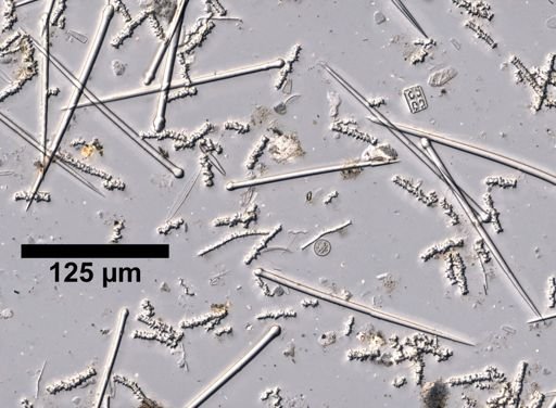Cliona cf. lobata