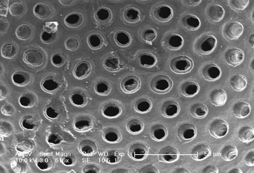 Sphaeroidinella dehiscens