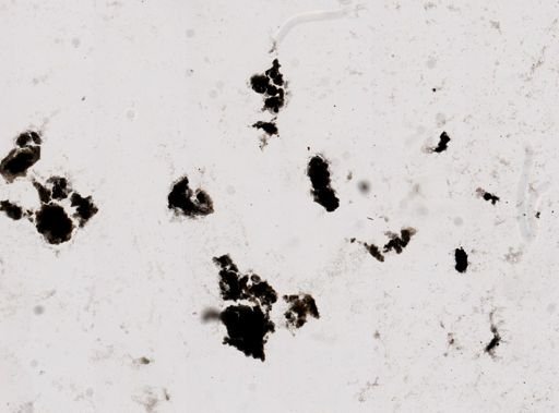 Pleistophora macrozoarcides