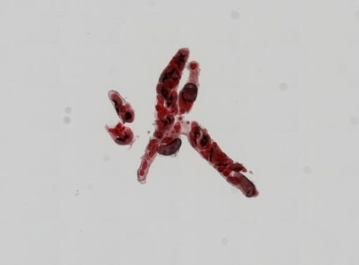 Trematoda