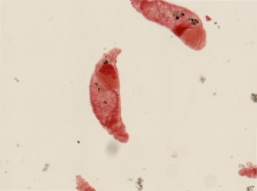Dinophilus gyrociliatus