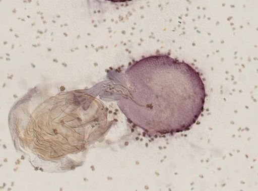 Otobothrium cysticum