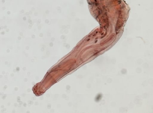 Oligacanthorhynchus microcephalus