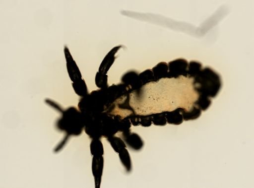 Pediculus humanus