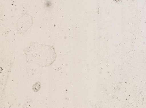 Plasmodium ovale
