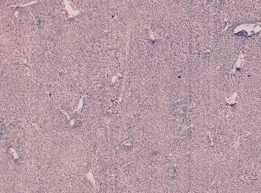 Plasmodium falciparum
