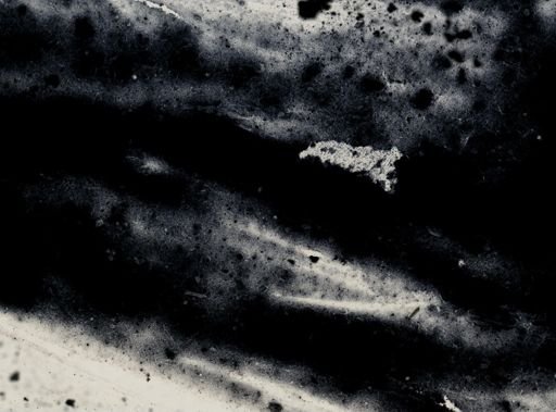 Entamoeba histolytica