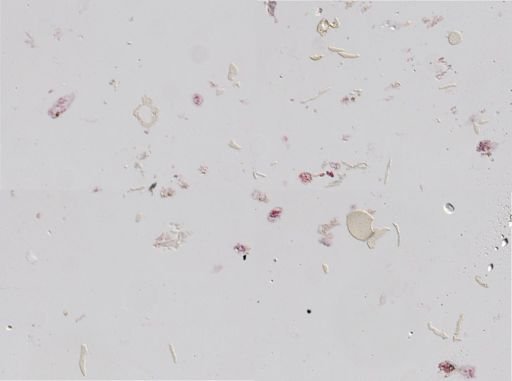 Distomum
