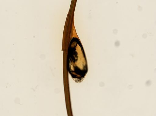 Pthirus pubis