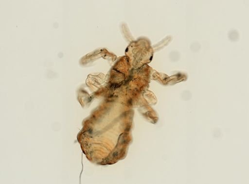 Pediculus humanus