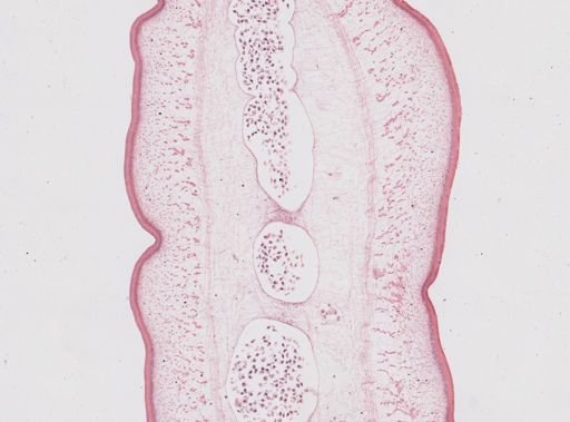Taenia saginata