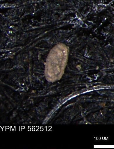 Miliammina ischnia