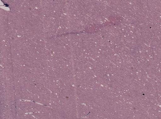 Plasmodium falciparum