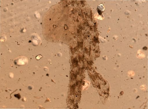 Bryozoa