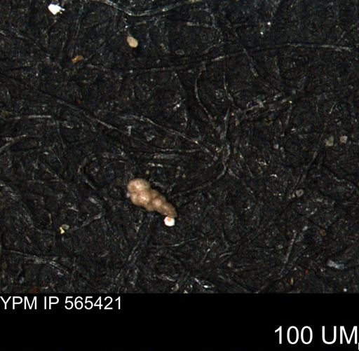 Verneuilina canadensis
