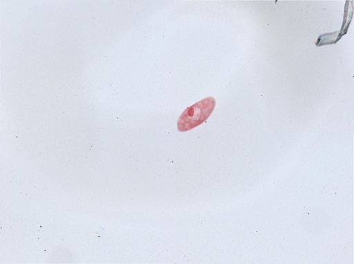 Paramecium aurelia