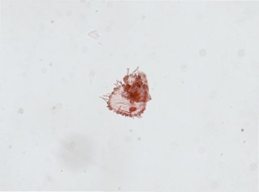 Obelia