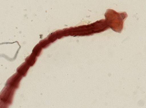 Dipylidium caninum