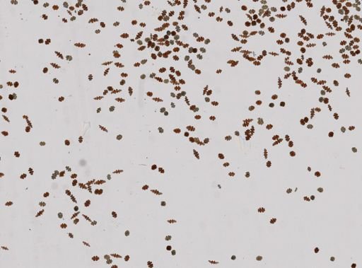 Eugorgia aurantiaca