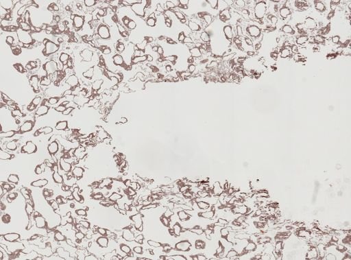 Astrosclera