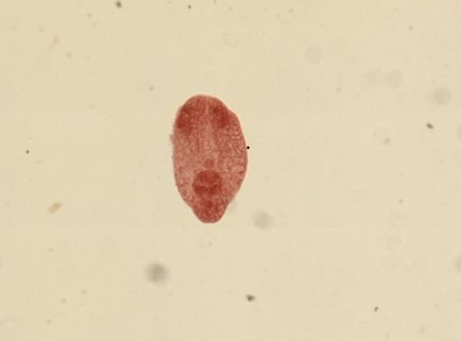 Tetracotyle