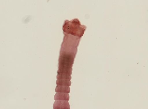 Dipylidium caninum